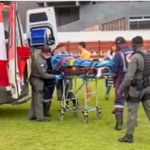 adolescente sofre queimaduras em São Roque do Canaã